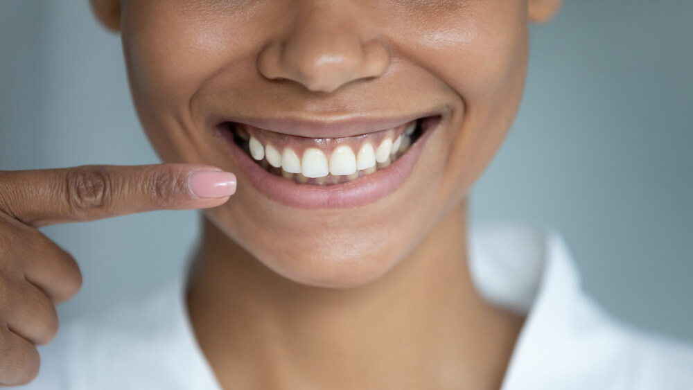 Gum grafts