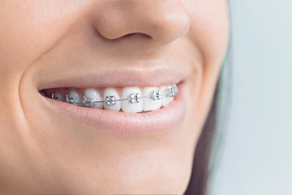Examen orthodontique clinique Cossette & Ruel